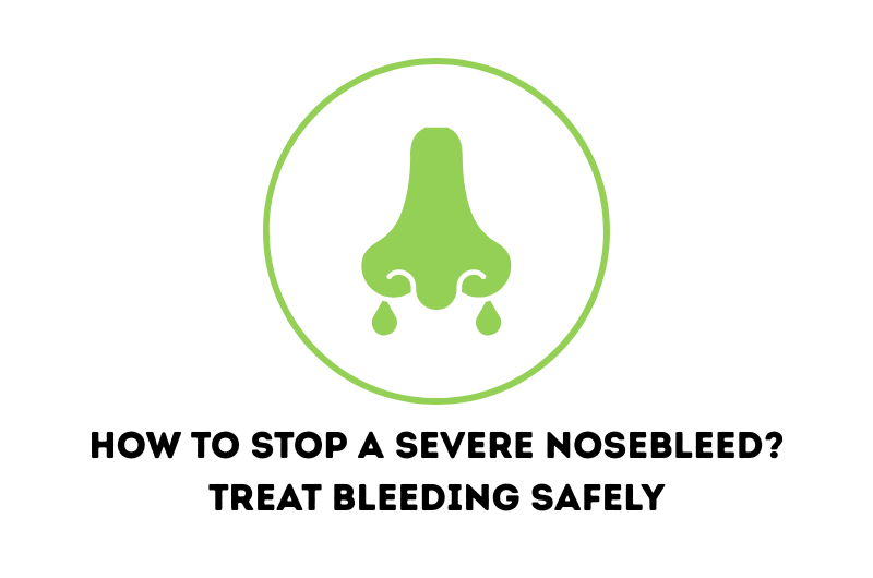 How to Stop a Severe Nosebleed? Treat Bleeding Safely
